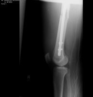 leg#3.JPG