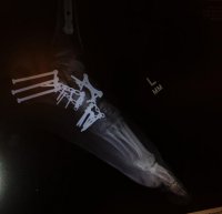 foot xray.jpg