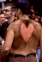 valentines-day-hair-loss.jpg