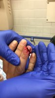 finger.jpg