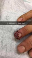 fingerstitch.jpg